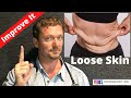 Fix LOOSE SKIN from Weight Loss (Cheap Options) 2020