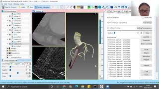 2.8 PM3 SimVascular Workshop 2020. Title: Anatomical modelling (8 of 10).