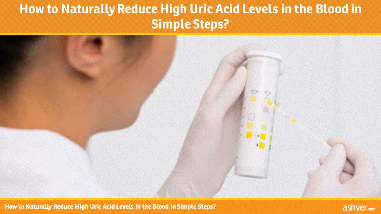 What is a cure for high uric acid levels?