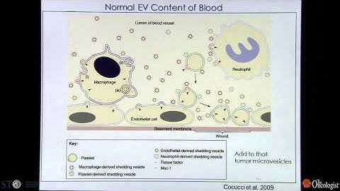 Exosomes as Biomarkers for Brain Tumors - by Xandra O. Breakefield, PhD