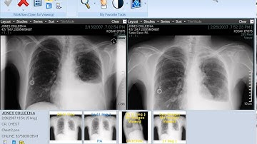 CARESTREAM Vue for Radiology: Image Display