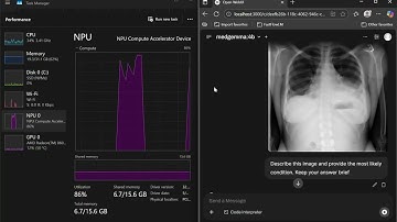 MedGemma:4B (Multimodal) Running Exclusively on AMD Ryzen™ AI NPU