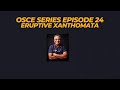 OSCE Series Episode 24 :  Eruptive Xanthomata