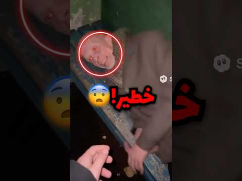 شاف مشرد نايم عند بيته ولمن قرب منه شاف عيونه كذا