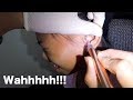 Girl's Dried-up Earwax Removal Using A New Ear Curette Kit from Healtheely