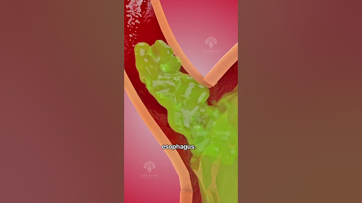How acid reflux happens 🥵  Acidity and gas problem | GERD #shorts #viralvideo - creativelearning3d