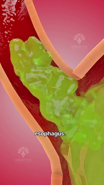 How acid reflux happens 🥵  Acidity and gas problem | GERD #shorts #viralvideo - creativelearning3d