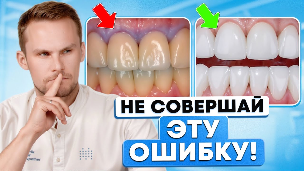 Что лучше МЕТАЛЛОКЕРАМИКА или ЦИРКОНИЙ? Лучшая КОРОНКА в 2025 году