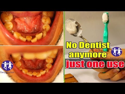 no Dentist anymore! only 2 minutes get whiten and shiny teeth like pearls!