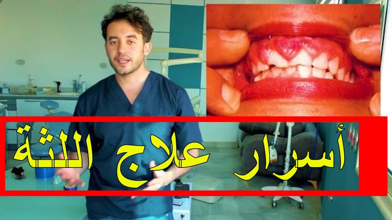 أسباب التهاب اللثة وعلاج التهاب اللثة فى سبع دقائق مع الدكتور محمد الزلوعى