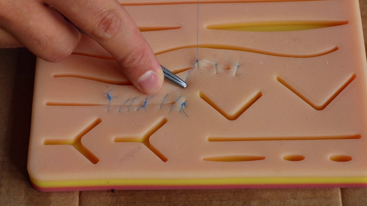 15- Continuous Irregular suture 