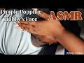 #ASMR | PIMPLE POPPING HUBBY'S FACE #asmr #nitpicking #pimplepopping #relaxing #viral