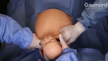 Gaumard® Victoria® S2200 : Cesarean Section Delivery How-To Ep 10/18