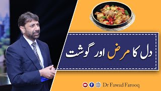 Meat and heart patient.Urdu/Hindi Dr.Fawad Farooq