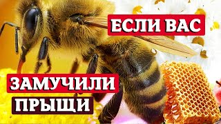 Здоровье пчеловода и ваших близких