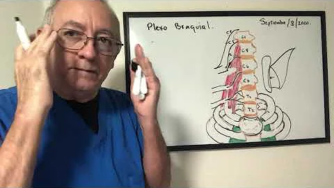 Como tratar lesão de plexo braquial?