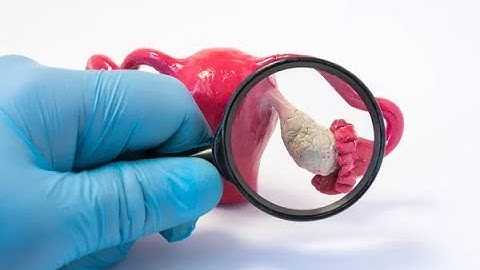 Ovarian Cystectomy | Oophorectomy | Cordocentesis | Chorionic villus sampling | Fetal stress test