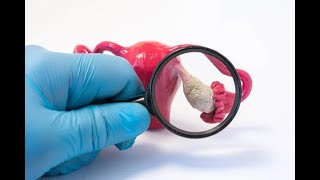 Ovarian Cystectomy | Oophorectomy | Cordocentesis | Chorionic villus sampling | Fetal stress test