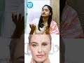 PDRN Injection - எந்த Skin Problemக்கு Best? Korean Skin Secret #shorts #glowingskin #brightskin
