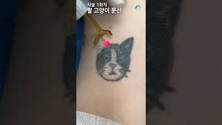 고양이 문신(타투)제거 ASMR - ALL 수면마취 [Laser Tattoo Removal]