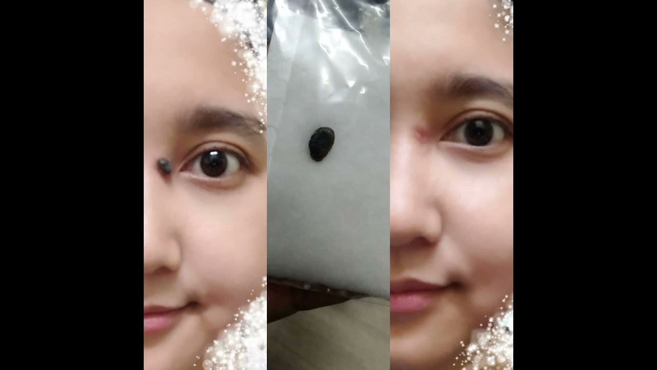 Kutil Cream Price Promotion Nov 2021 Biggo Malaysia