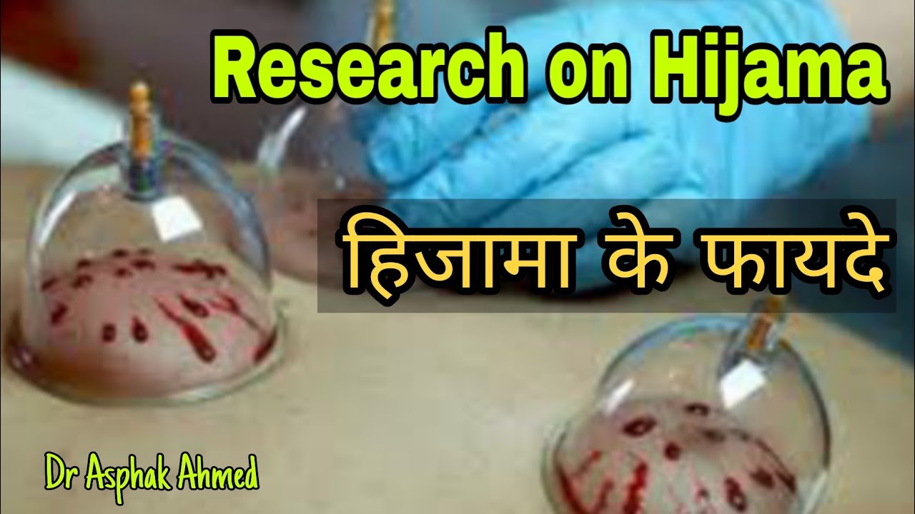 hijama-ke-fayde-benefits-of-cupping-therapy-hijama-in-lucknow-dr