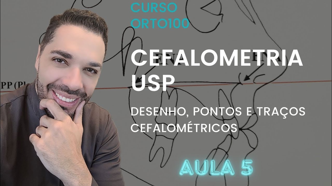 AULA 5: CEFALOMETRIA USP UNICAMP - Desenhos, pontos, traçados e análise cefalométria USP.