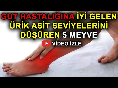 Video: Ürik Asit Düzeylerini Azaltmanın 4 Kolay Yolu