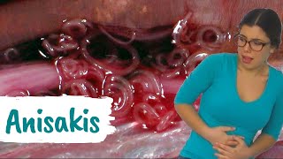 Cosa succede se mangi l'Anisakis?