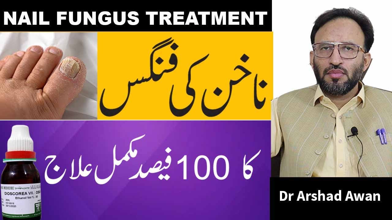 How To Treat Nail Fungus Infection Permanently In Urdu YouTube