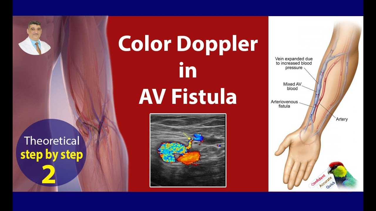 AV Fistula Doppler Assessment - theoretical - step by step - part  B