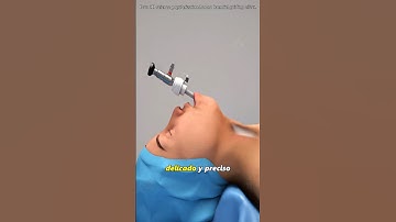 How Thyroidectomy Is Done (3D Animation) #3dmedicalanimation #foryou #shortvideo #thyroid #us