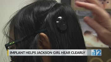 Bone conduction implant helps Jackson girl hear better