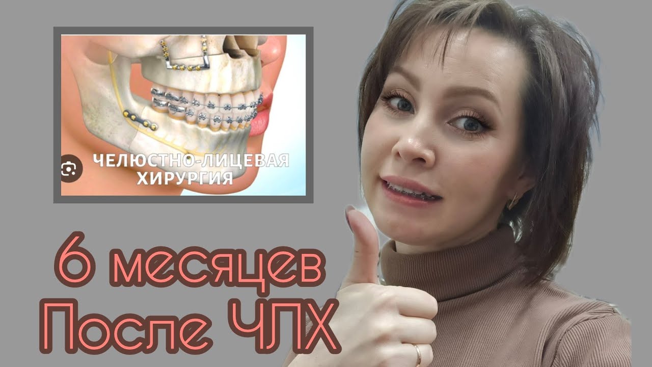 #26 Пол года после ЧЛХ.