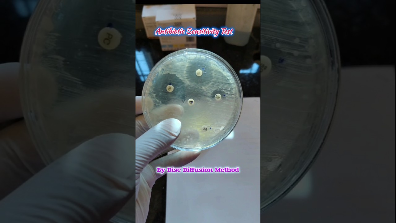 Antibiotics Sensitivity Test 