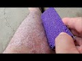 Purple Pumice vs Psoriasis Skin Flakes