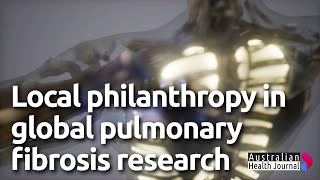 Global collaboration in pulmonary fibrosis research