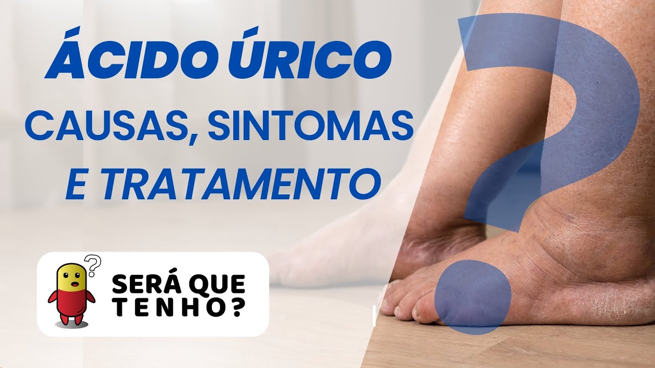 ACIDO URICO - CAUSAS, Sinais, Sintomas e TRATAMENTOS - Será que eu ...