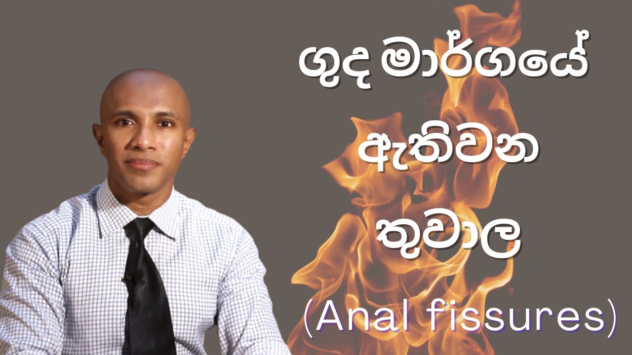 ගුද මාර්ගයේ ඇතිවන තුවාල (anal fissure) - වෛද්‍ය දක්ෂිත වික්‍රමසිංහ සෞඛ්‍යය අධ්‍යාපන වීඩියෝව