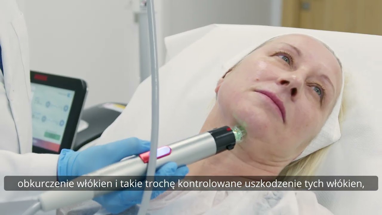 Radiofrekwencja mikroigłowa w Kaczyńscy Clinic