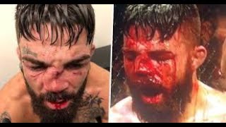 Download Lagu Ozcan  \ MP3