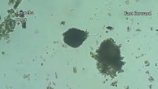 Testate amoeba eats a cell and builds armor #microscopy
