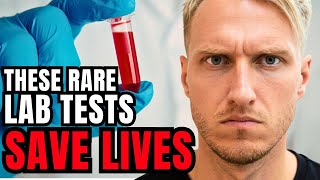 5 Important Blood Tests EVERYONE Should Get [But Very Few Do]