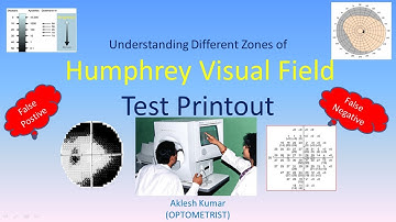 Understanding different zones of Humphrey Visual Field test printout