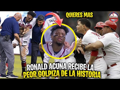 La Vez Que RONALD ACUÑA JR Recibió La PEOR GOLPIZA De La HISTORIA | MLB