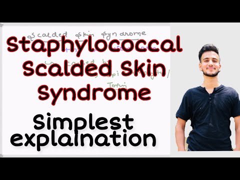 Staphylococcal Scalded Skin Syndrome (SSSS) #Scalded_Skin_Syndrome