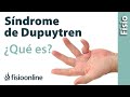 ¿Qué es el síndrome o enfermedad de Dupuytren?