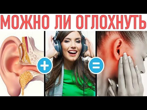 МОЖНО ЛИ ОГЛОХНУТЬ ОТ НАУШНИКОВ | Чем опасны наушники для слуха