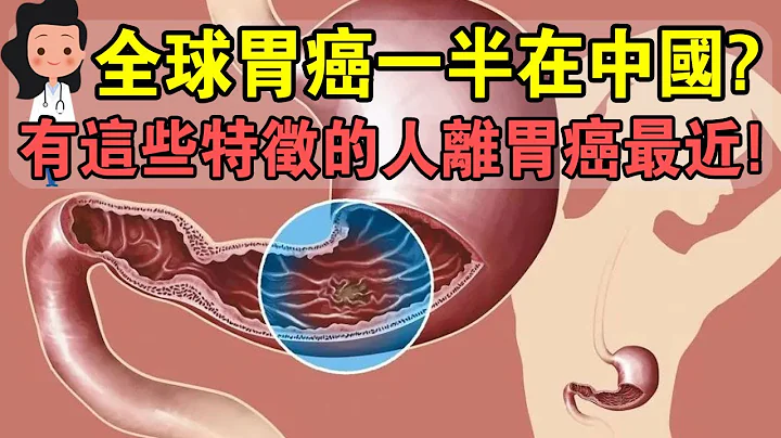 《柳葉刀》發布涉及10萬中國人的研究， 如果有這些特徵，說明妳離胃癌最近！ - 天天要聞