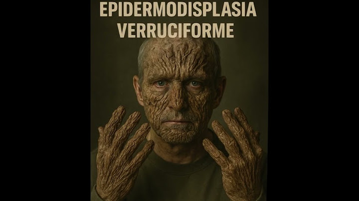 TOP 5 Enfermedades Más Raras del Mundo: Ciencia y Misterio Real